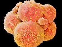Test once know 15 thousand types of genetic diseases