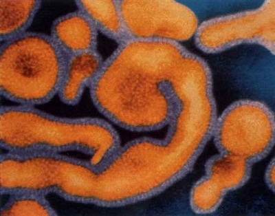 Test two drugs Ebola and Marburg