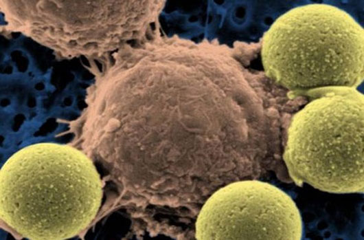 Testing breakthroughs to cure blood cancer