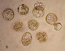 Thailand: Using stem cells to treat heart failure