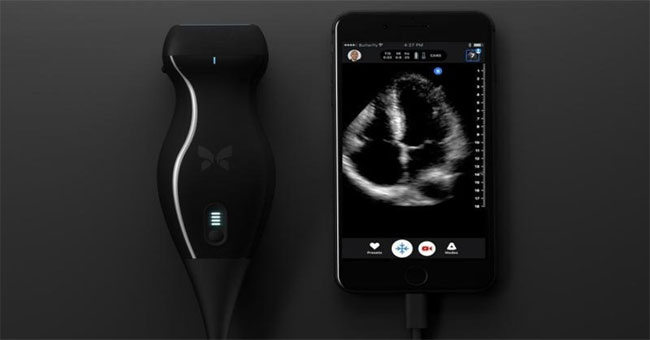 Thanks to the invention of a handheld ultrasound machine, the doctor ...