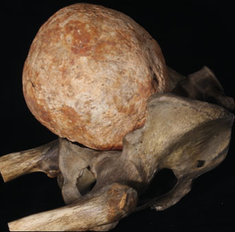 The 200-year-old stone uterus weighs 3kg in England