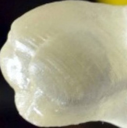 The 3D printed denture can clean itself