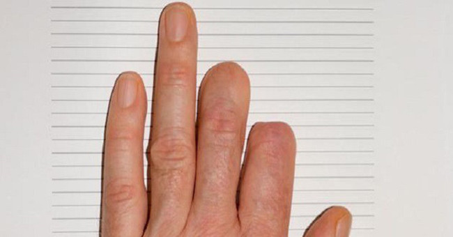 The 7-year-old girl has the ability to grow back her fingers no different from Namek