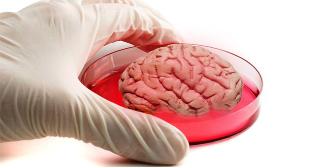 The American scientists raised 'mini brains' to live up to 9 months in vitro