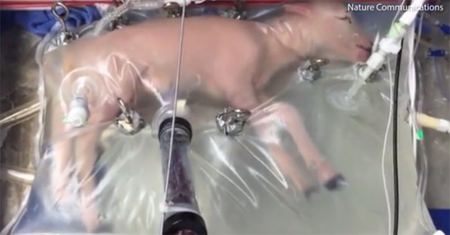 The artificial uterus was successfully tested for the second time