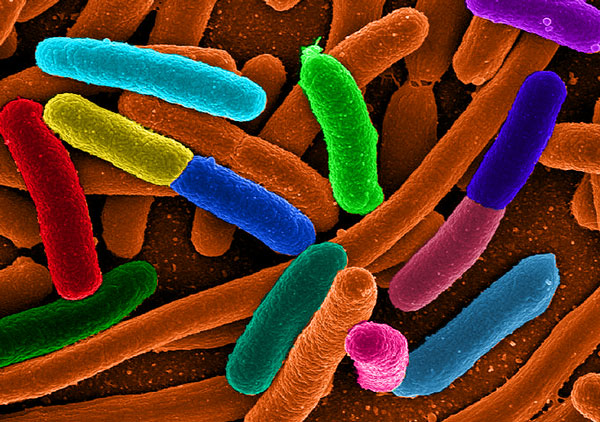 The awiss wireless sensor helps detect bacteria e.coli in water