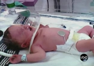 The baby cannot cry