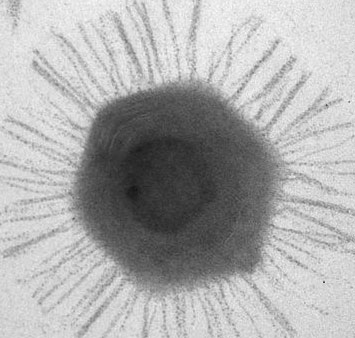 The biggest virus in the world is exposed