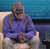 The blue-skinned man died