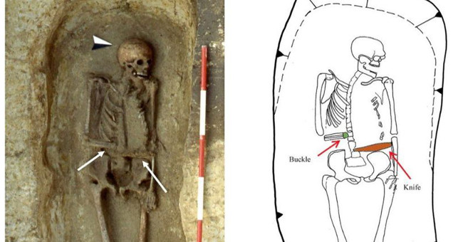 The body of the medieval man fitted a knife instead of a hand