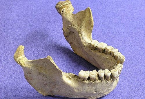 The bone fragments reveal the