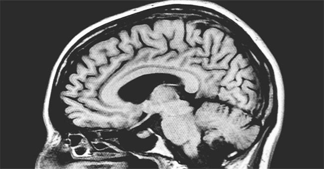 The boy has lost 1/6 of his brain, after 3 years he still lives normally without knowing anything