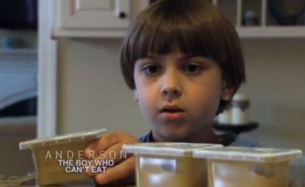 The boy kept eating and died