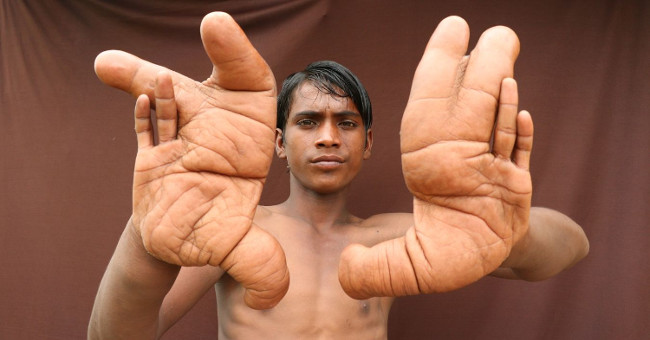 The boy's gigantic hand made the medicine clasped
