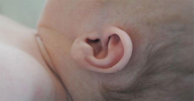 The brain has the ability to eliminate noise