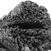 The brain is well preserved 4,000 years