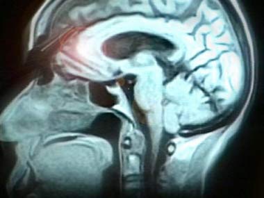 The brain pays attention in two ways