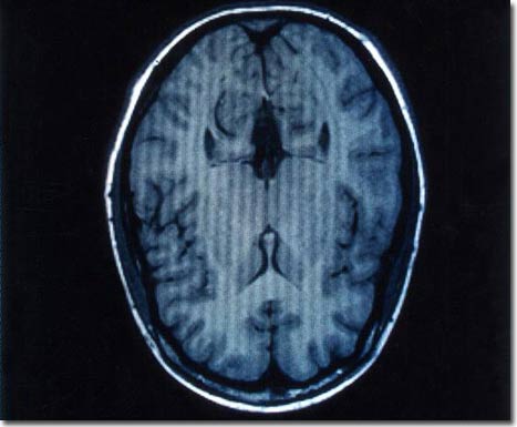 The 'brain reading' device can predict what people see