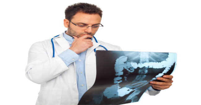 The cancer has no symptoms early