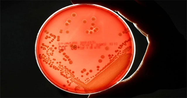 The cancer-causing HP virus has become twice as difficult to kill