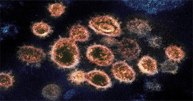 The cell adhesion capacity of SARS-CoV-2 virus is 1,000 times stronger than SARS