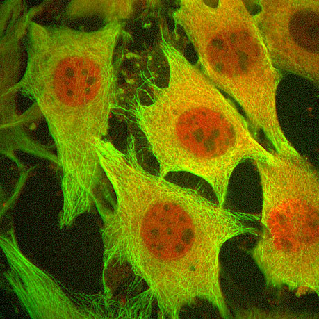The compound promotes cell death and prevents cancer cells