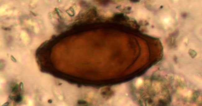 The culprit makes us infected with worms, lice are ... ancient Romans