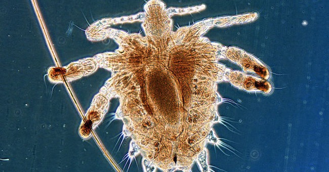 The cure for pubic lice is simple and cheap