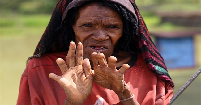 The custom of cutting off the fingers to worship the husbands of Danai tribal women