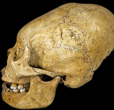 The custom of extending the skull of the South American tribe