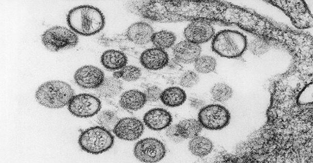 The dangerous viruses on Earth