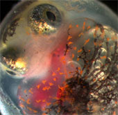 The Deepwater Horizon oil spill causes fish defects