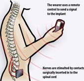 The device helps women to 'top' with the button