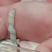 The device increases the productivity of recovery of stem cells from umbilical cord blood