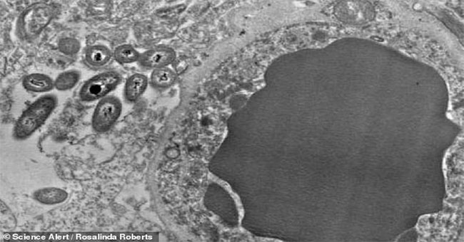 The discovery caused a stir in a microbial system that lives right in the human brain
