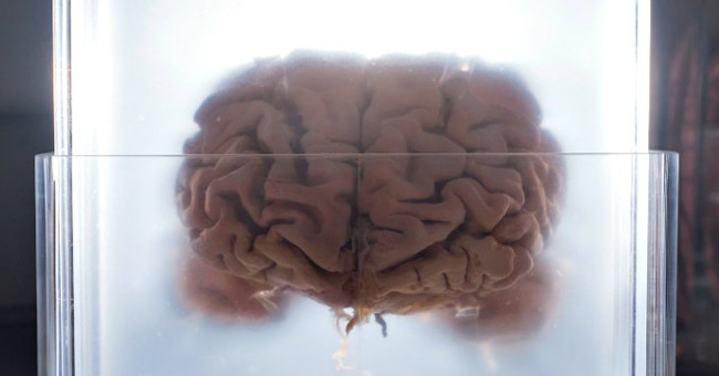 The discovery explains why people are more susceptible to neurological diseases than other species