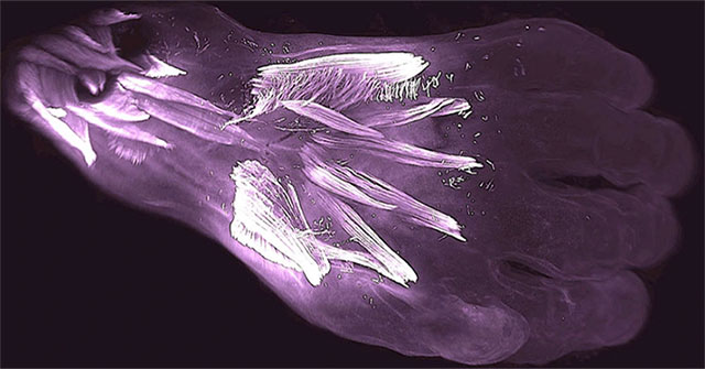 The discovery of 'muscle disappearing' in humans more than 250 million years ago
