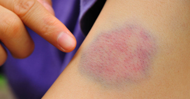 The diseases are most likely to cause death when you are young