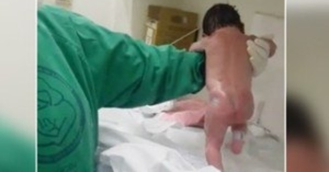The doctor explained the phenomenon that the baby has just born