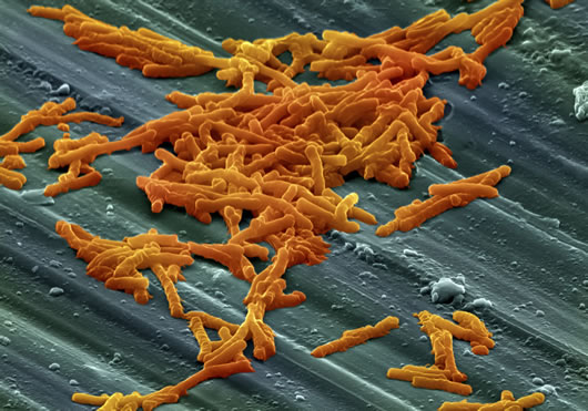 The drug-resistant virus spreads widely in Europe