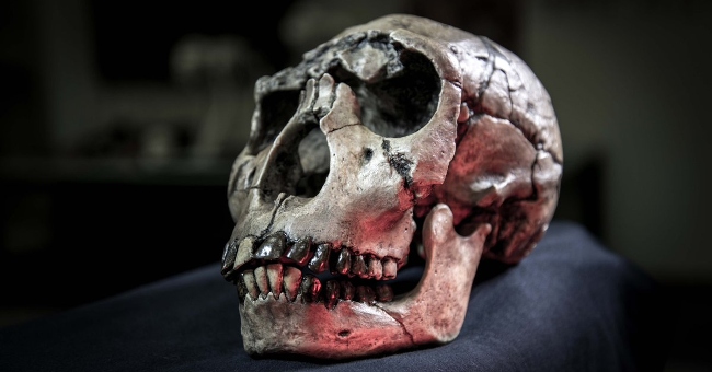The evolution of humanity will make wisdom teeth disappear
