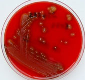 The fast-growing cannibalism bacteria