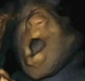 The fetus also knows how to yawn