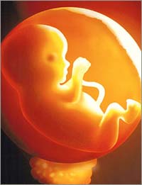 The fetus and newborn are very sensitive to pollutants