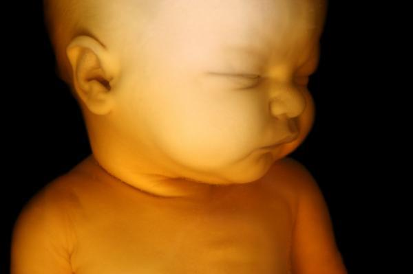 The fetus 'sleep cycle'