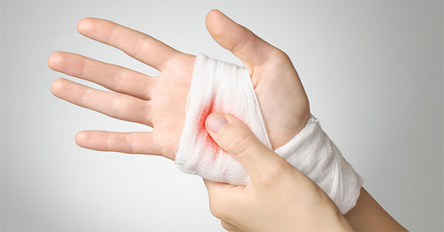 The first aid when a hand is broken