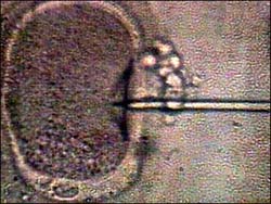 The first birth from an unmarried oocyte