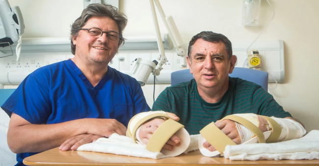 The first man implanted both hands in England