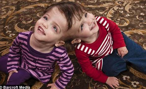 The first pair of twins can look through each other's eyes
